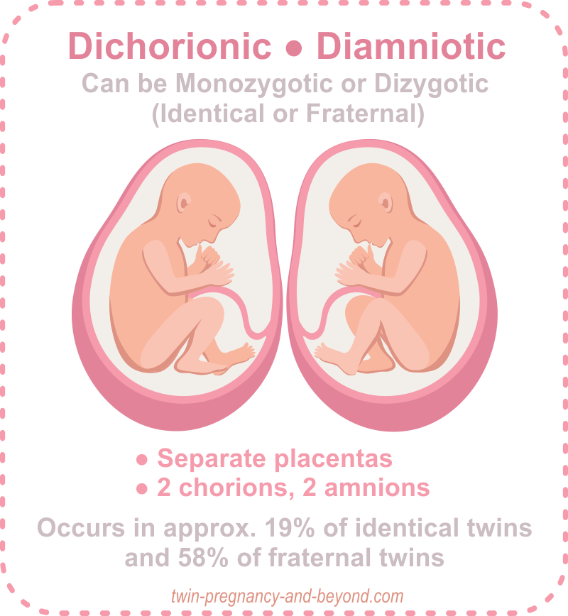 placentation-of-twins-how-many-placentas-in-a-twin-pregnancy