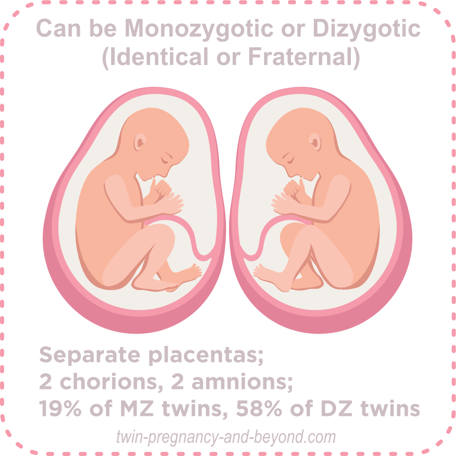 What Is Twin Zygosity - Understanding Different Types Of Twinning