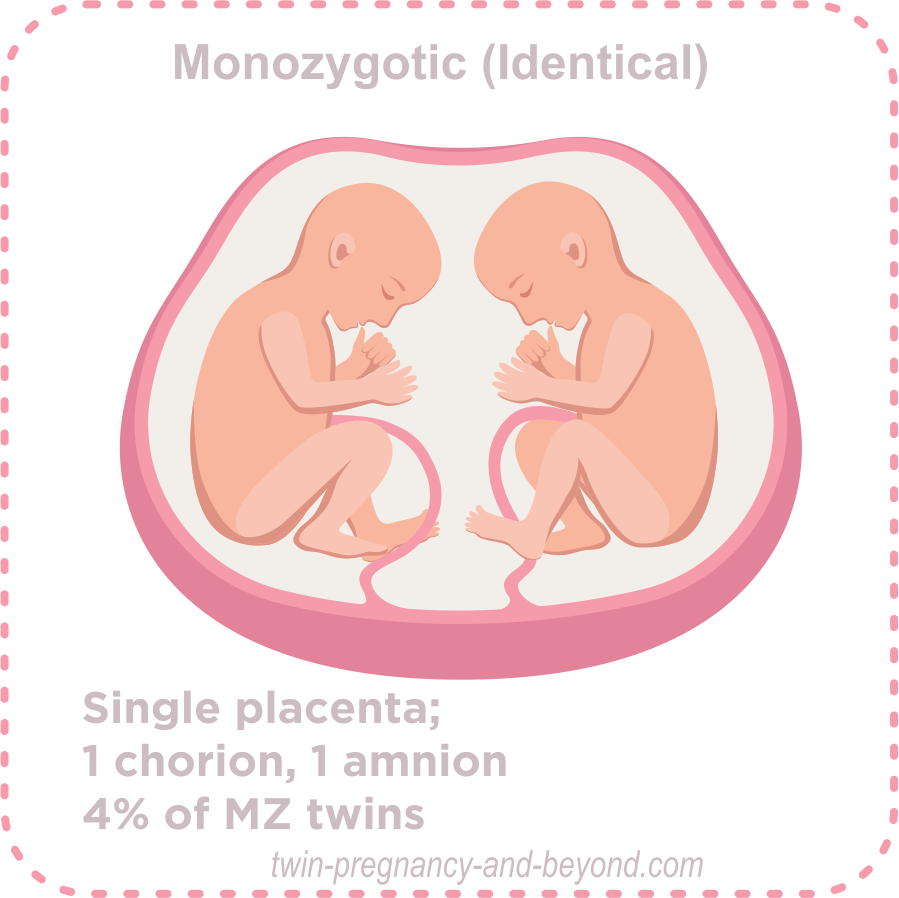 What Is Twin Zygosity Understanding Different Types Of Twinning